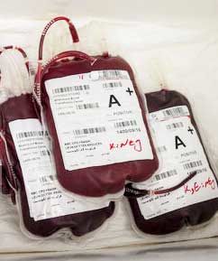 مهم‌ترین چالش‌های مراکز انتقال خون
